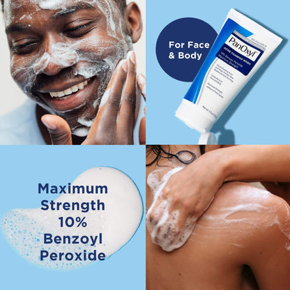 غسول بانوكسيل رغوي لحب الشباب بنزويل بيروكسيد 10% – 156جم Panoxyl Acne Foaming Wash Benzoyl Peroxide 10%